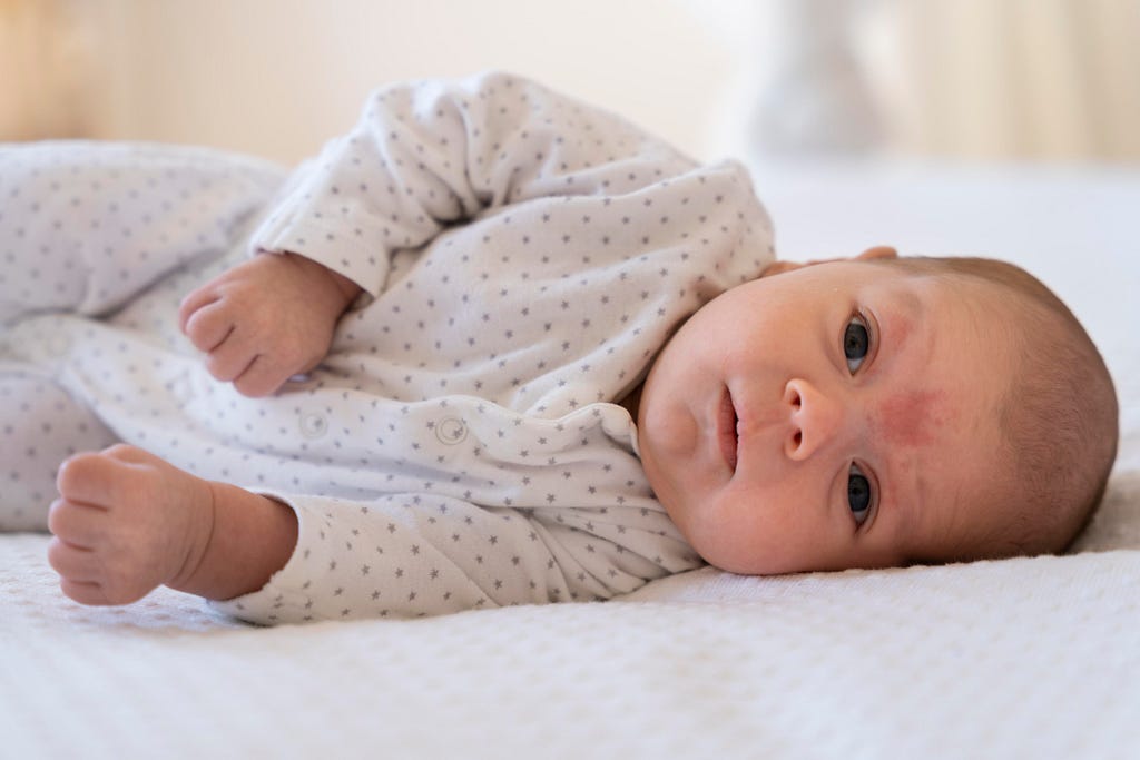 7 Foods to Avoid in Babies and Toddlers With Eczema